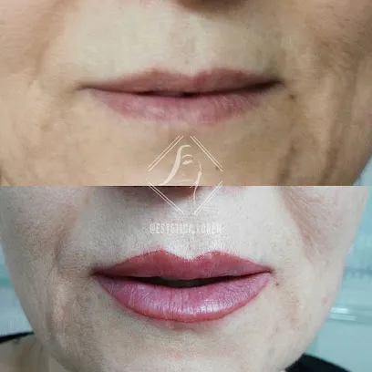 Estética Loren