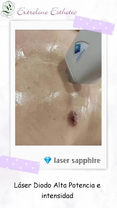 Extreline Esthetic