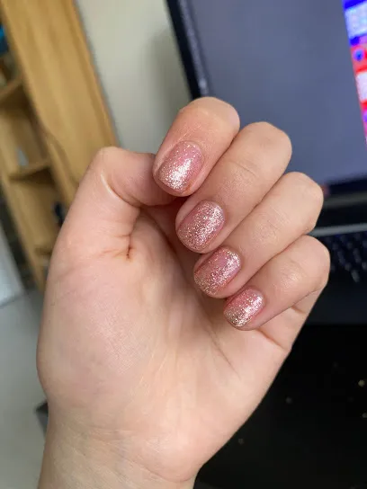 Lucky Uñas
