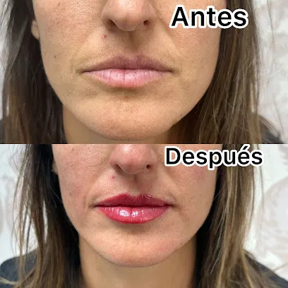 Martty | Extensiones de pestañas