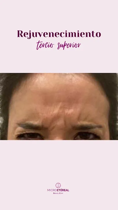 MicroEtereal Beauty Clinic
