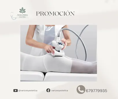 VARICES y Estética