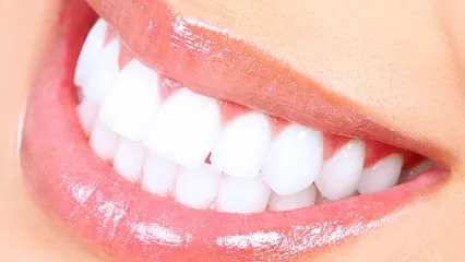 White Smile